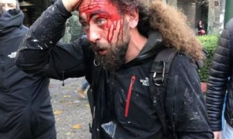 Καταγγελία- σοκ για “δολοφονικές” επιθέσεις ακραίων “διαδηλωτών” σε φωτορεπόρτερ και εικονολήπτες