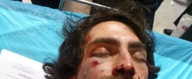 Πατέρας φοιτητή: Όταν μισείς τον συνάνθρωπό σου είσαι…Χρυσή Αυγή