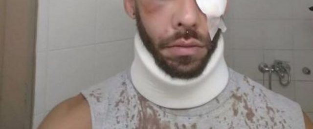 Ομοφοβική επίθεση εναντίον φοιτητή στο Ρέθυμνο – Καταδίκη από τον ΣΥΡΙΖΑ