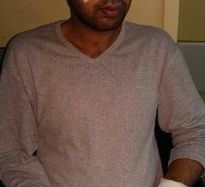 Καταγγελία για νέα επίθεση σε μετανάστη από ομάδα 10 ατόμων