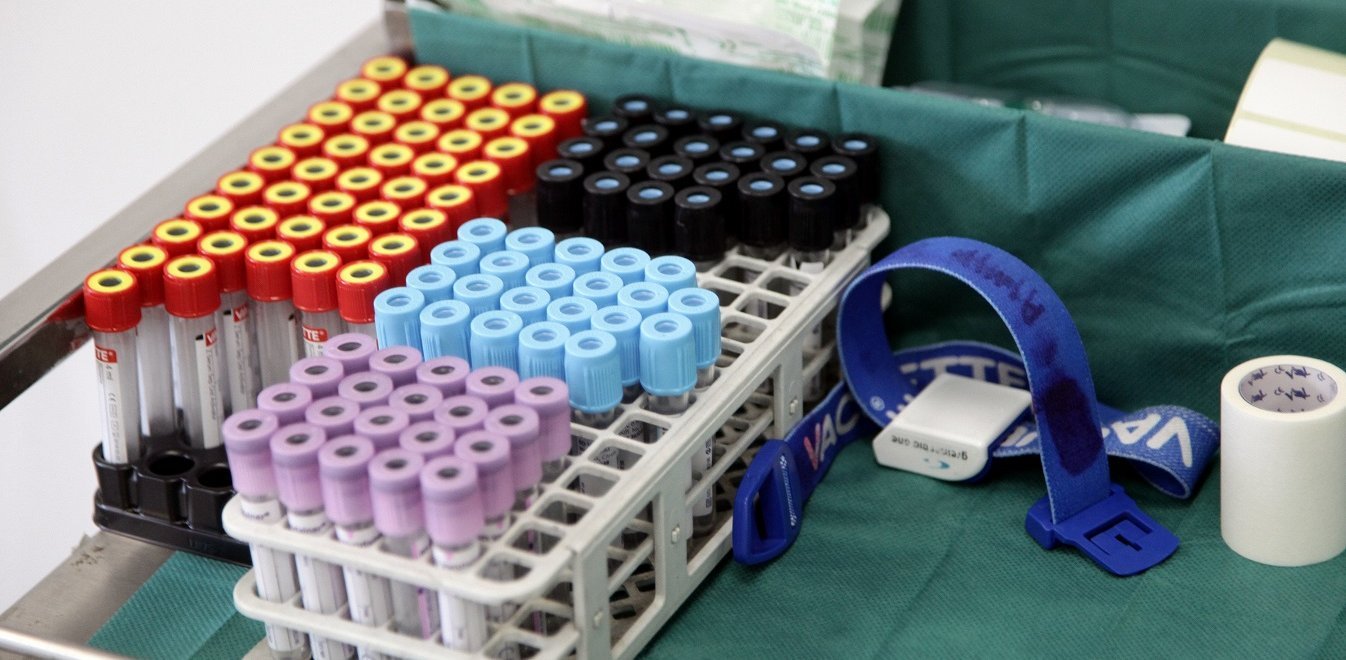 Ανέστειλαν τις κινητοποιήσεις τους τα διαγνωστικά κέντρα