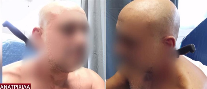 Σοκ στην Καλαμάτα: Μαχαίρωσε στο λαιμό τον κουμπάρο της (vid)