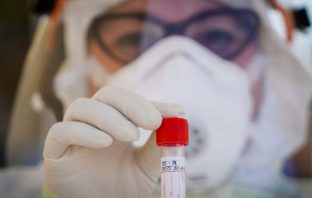 Συμφωνία Κομισιόν – Sanofi για 300 εκατομμύρια εμβόλια κατά του Covid-19, εάν… βρεθεί