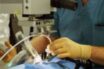 Η πανδημία ακυρώνει εκατομμύρια χειρουργεία παγκοσμίως