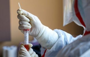 Η Covid-19 μπορεί να επηρεάσει το προσδόκιμο ζωής σε πολλές χώρες