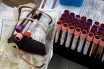 ΗΠΑ-Covid-19: Η θεραπεία με πλάσμα αίματος αναρρωσάντων δεν βοήθησε τους ασθενείς με ήπια έως μέτρια συμπτώματα
