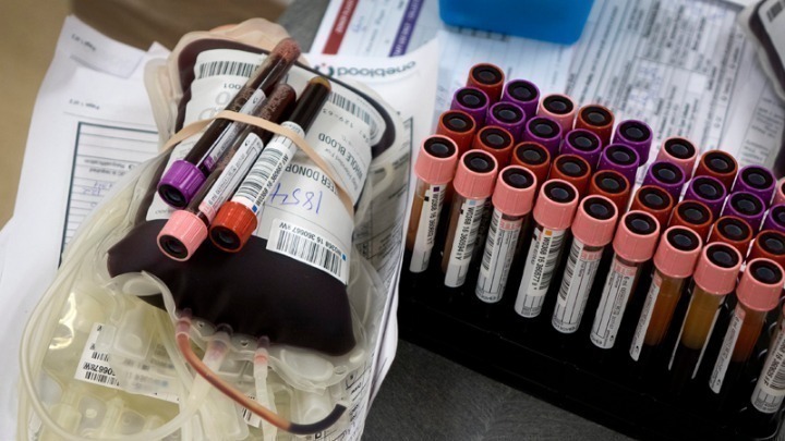 ΗΠΑ-Covid-19: Η θεραπεία με πλάσμα αίματος αναρρωσάντων δεν βοήθησε τους ασθενείς με ήπια έως μέτρια συμπτώματα