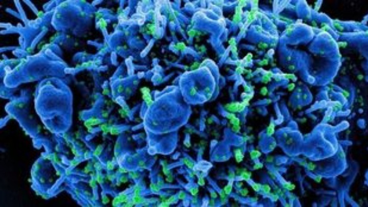 Ανησυχία: : Ένας στους τέσσερις με μακρά Covid-19 εμφανίζουν σημάδια αυτοάνοσης νόσου ένα χρόνο μετά