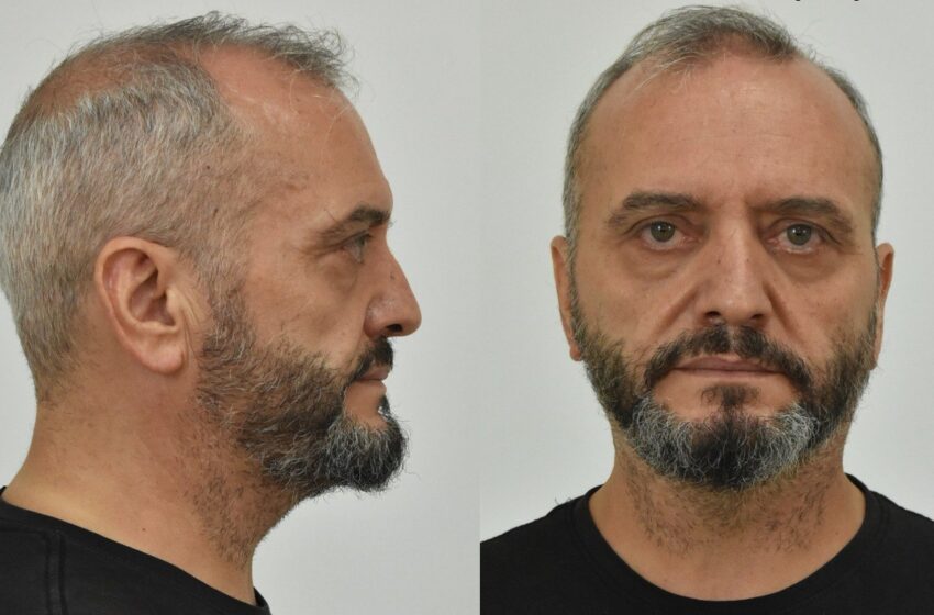 Προκλητικοί ισχυρισμοί των κατηγορούμενων παιδοβιαστών στις απολογίες τους: «Για όλα φταίει η 12χρονη»