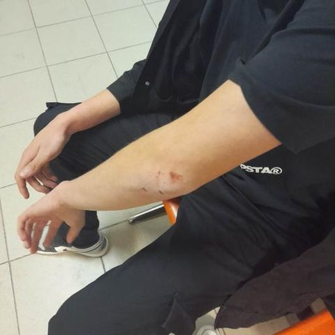 Θεσσαλονίκη – Καταγγελία: Αστυνομικοί έδειραν άγρια 17χρονο και έφυγαν