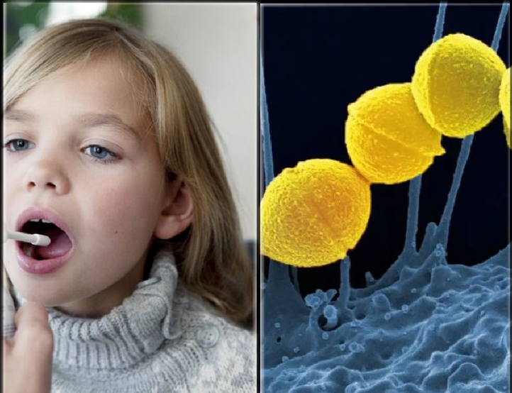 Στρεπτόκοκκος: Τι πρέπει να προσέχουν οι γονείς