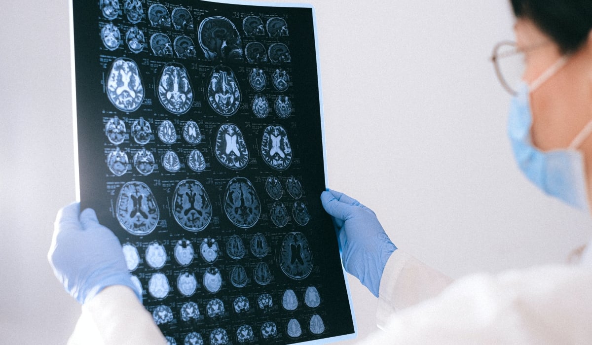 Δημιουργία Εθνικού Δικτύου 17 Μονάδων Εγκεφαλικών