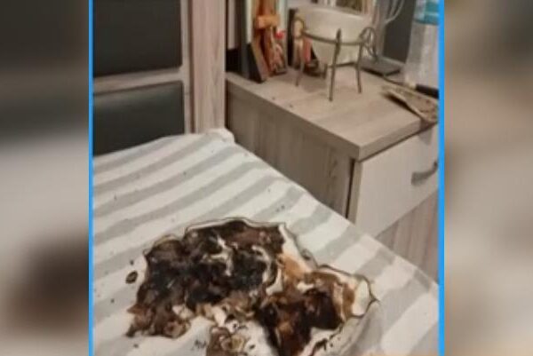 Σοβαρός τραυματισμός νεαρού από έκρηξη κινητού τηλεφώνου 