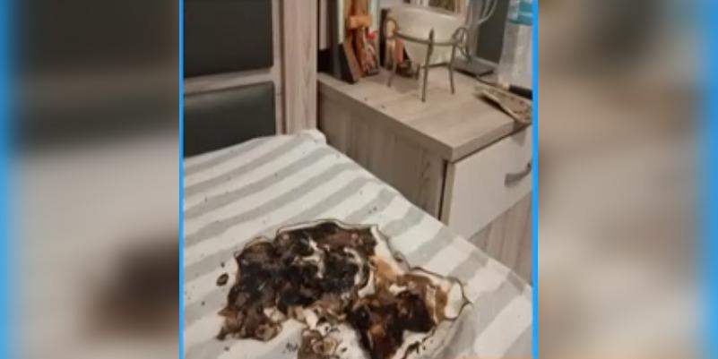 Σοβαρός τραυματισμός νεαρού από έκρηξη κινητού τηλεφώνου