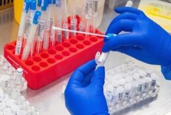 ΠΟΥ: Ο κίνδυνος για τον άνθρωπο από τη γρίπη των πτηνών παραμένει χαμηλός 