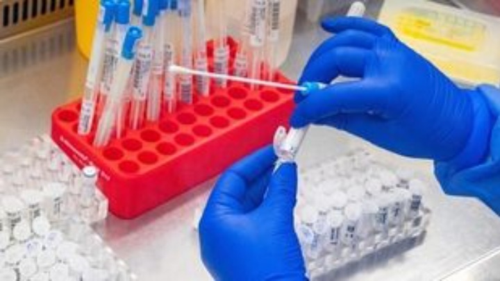 ΠΟΥ: Ο κίνδυνος για τον άνθρωπο από τη γρίπη των πτηνών παραμένει χαμηλός