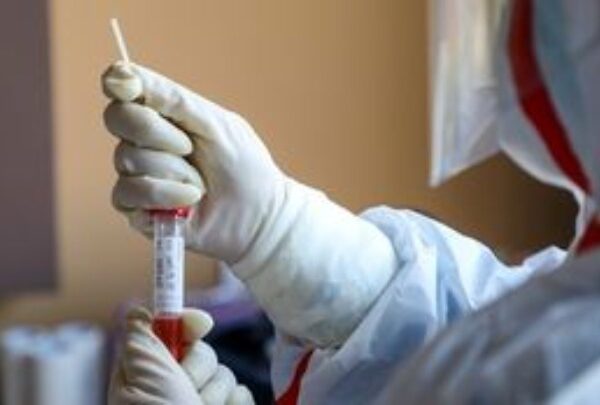 Πέντε χρόνια μετά την εμφάνιση του covid είμαστε προετοιμασμένοι να αντιμετωπίσομε την επόμενη πανδημία; Όχι!