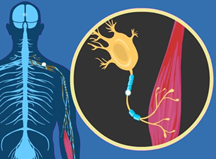 Τι είναι το σύνδρομο ALS με το οποίο δίνει μάχη ο Έρικ Ντέιν 