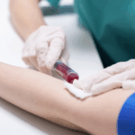 Υποδόρια Ένεση Nivolumab: Μια Επανάσταση στη Θεραπεία του Καρκίνου