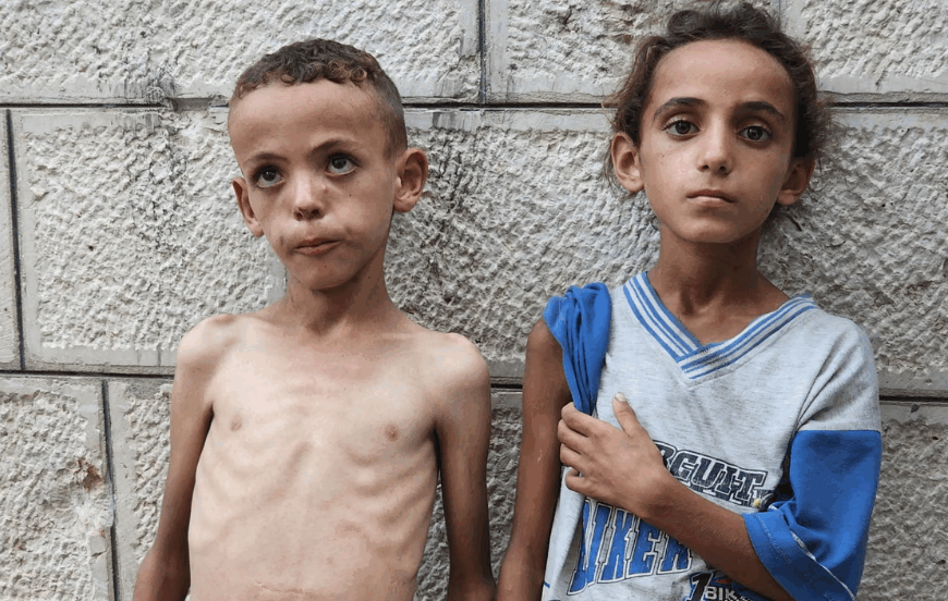 Γάζα: Σκελετωμένα παιδιά γεμίζουν νοσοκομεία