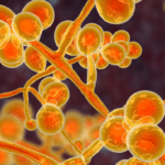 Candida auris: Ένας ανθεκτικός στα φάρμακα μύκητας εξαπλώνεται «ταχέως» στα νοσοκομεία της Ευρώπης