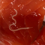 Σοβαρή δηλητηρίαση από σούσι σε 22χρονο στη Θεσσαλονίκη – Τι είναι το Anisakis