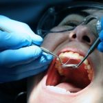 Ουλίτιδα και καρδιά: Πώς η στοματική υγεία συνδέεται με τον καρδιαγγειακό κίνδυνο