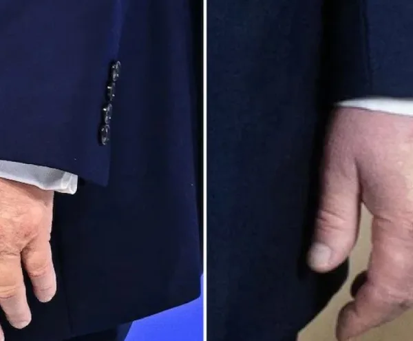 Όσο πάει και… μελανιάζει ο Τραμπ