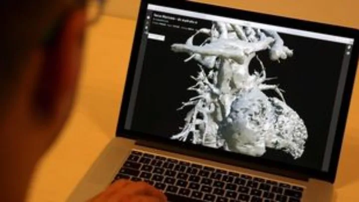 Καρδιακή ανεπάρκεια: Η «σιωπηλή πανδημία» της τρίτης ηλικίας και το στοίχημα των εξειδικευμένων ιατρείων